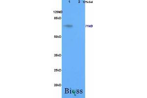 L1 rat brain, L2 rat liver lysates probed (ABIN708101) at 1:200 in 4 °C. (GALC antibody  (AA 301-400))