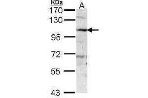 WB Image Sample (30 ug of whole cell lysate) A: A431 , 7. (AOC3 antibody)