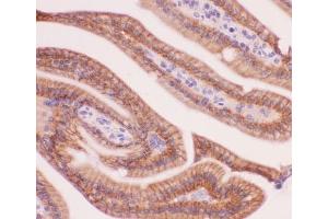 IHC-P: alpha Catenin antibody testing of mouse intestine tissue (CTNNA1 antibody  (AA 143-292))