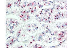 Anti-LIMD1 antibody IHC staining of human adrenal. (LIMD1 antibody  (AA 438-467))