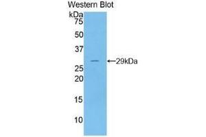 Detection of Recombinant DNASE1, Human using Polyclonal Antibody to Deoxyribonuclease I (DNASE1) (DNASE1 antibody  (AA 19-259))