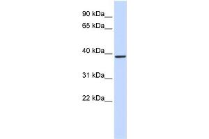 WB Suggested Anti-QPCT Antibody Titration:  0. (QPCT antibody  (Middle Region))