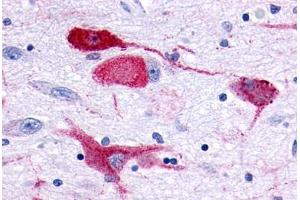 Anti-GPR83 antibody  ABIN1048883 IHC staining of human brain, neurons and glia.