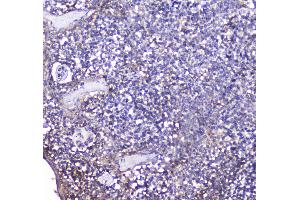 IHC analysis of BCMA using anti-BCMA antibody . (BCMA antibody  (AA 1-54))