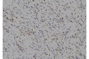ABIN6277264 at 1/100 staining Human gastric tissue by IHC-P. (MMP14 antibody  (C-Term))