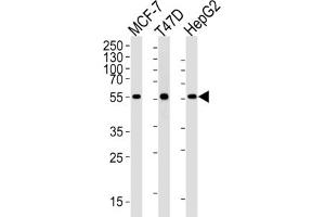 Western Blotting (WB) image for anti-Aldehyde Dehydrogenase 6 Family, Member A1 (ALDH6A1) antibody (ABIN2995317)