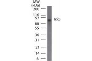 Image no. 1 for anti-Inhibitor of kappa Light Polypeptide Gene Enhancer in B-Cells, Kinase beta (IKBKB) antibody (ABIN208072)