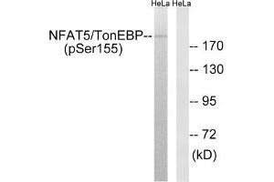 Western blot analysis of extracts from HeLa cells, treated with forskolin (40nM, 30 mins), using NFAT5/TonEBP (Phospho-Ser155) antibody. (NFAT5 antibody  (pSer155))