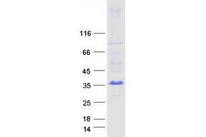 ADP-Ribosylation Factor-Like 10 (ARL10) protein (Myc-DYKDDDDK Tag)