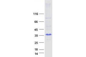 Validation with Western Blot (ARL10 Protein (Myc-DYKDDDDK Tag))