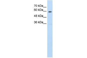 SLC11A1 antibody used at 1. (SLC11A1 antibody  (C-Term))