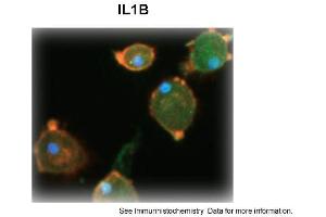 Sample Type: Human Macrophange CellsGreen: primaryRed: phallodinBlue: DAPIYellow: green/redPrimary Dilution: 1:200Secondary Antibody: anti-Rabbit IgG-FITCSecondary Dilution: 1:1000Image Submitted By: Milan FialaUniversity of California, Los Angeles (IL-1 beta antibody  (N-Term))