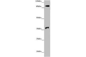 Western blot All lanes: DNMT3B antibody at 14 μg/mL + Hela whole cell lysate Secondary Goat polyclonal to rabbit IgG at 1/10000 dilution Predicted band size: 96, 94, 87, 81, 89, 95, 78, 82 kDa Observed band size: 96, 37 kDa (DNMT3B antibody  (AA 1-100))