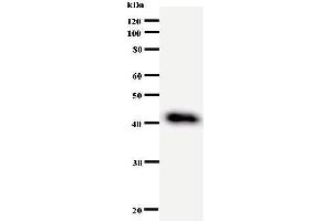 Western Blotting (WB) image for anti-DEAD (Asp-Glu-Ala-Asp) Box Polypeptide 27 (DDX27) antibody (ABIN933004)