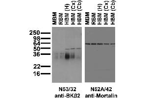 Immunoblot against crude membrane fractions from whole mouse (MBM) or rat (RBM) brain and from human hippocampus [HBM(H)], cerebral cortex [HBM(Cx)] or cerebellum [HBM(Cb)] and probed with N53/32 (left) or N52A/42 (right) TC supe.
