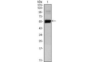 Western Blot showing PAX6 antibody used against human PAX6 (AA: 1-223) recombinant protein. (PAX6 antibody)