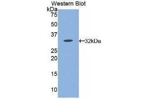 Western blot analysis of the recombinant protein. (CD38 antibody  (AA 54-301))