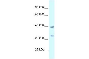 Western Blot showing STOML2 antibody used at a concentration of 1 ug/ml against 721_B Cell Lysate (STOML2 antibody  (C-Term))