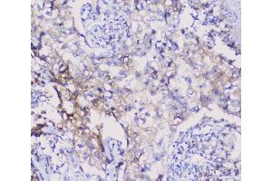 IHC analysis of NSE using anti-NSE antibody (ABIN6719549). (ENO2/NSE antibody)