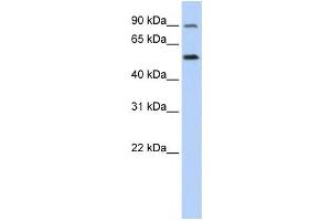 Western Blotting (WB) image for anti-Solute Carrier Family 41, Member 1 (SLC41A1) antibody (ABIN2458818)