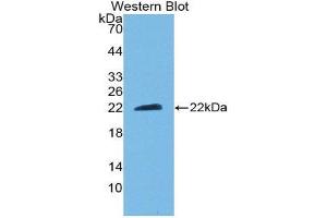 Western Blotting (WB) image for anti-Ciliary Neurotrophic Factor (CNTF) (AA 2-198) antibody (ABIN3209714) (CNTF antibody  (AA 2-198))