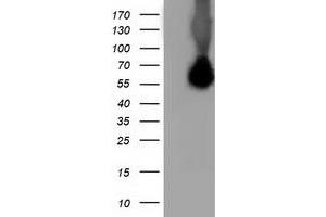 Image no. 1 for anti-Sequestosome 1 (SQSTM1) antibody (ABIN1499991) (SQSTM1 antibody)