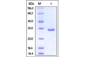 Human PSME3, His Tag on SDS-PAGE under reducing (R) condition. (PSME3 Protein (PSME3) (AA 2-254) (His tag))