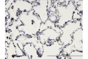 Immunoperoxidase of monoclonal antibody to MBD1 on formalin-fixed paraffin-embedded human lung. (MBD1 antibody  (AA 415-508))