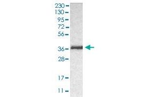 Western blot analysis of human RT-4 cell line with CRKL polyclonal antibody . (CrkL antibody  (AA 125-301))