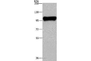 Western blot analysis of Raji cell, using PTK2B Polyclonal Antibody at dilution of 1:300 (PTK2B antibody)