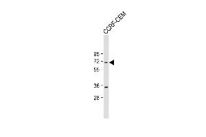Anti-HS Antibody (Center) at 1:2000 dilution + CCRF-CEM whole cell lysate Lysates/proteins at 20 μg per lane. (HSPA7 antibody  (AA 169-196))
