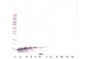 Image no. 3 for anti-gamma-Interferon-Induced Monokine (CXCL9) antibody (ABIN465139) (CXCL9 antibody)