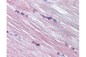 Anti-AMPD1 antibody IHC of human skeletal muscle. (AMPD1 antibody  (AA 140-190))