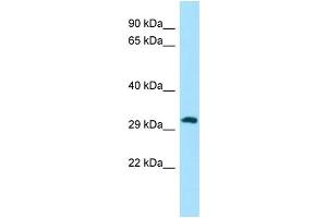 Host: Rabbit Target Name: PIH1D1 Sample Type: A549 Whole Cell lysates Antibody Dilution: 1. (PIH1D1 antibody  (C-Term))