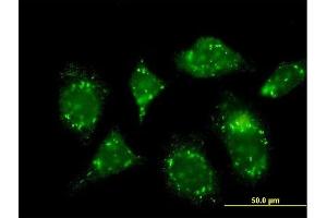 Immunofluorescence of monoclonal antibody to RABGAP1 on HeLa cell. (RABGAP1 antibody  (AA 1-110))