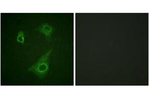 Immunofluorescence analysis of HepG2 cells, using Epo-R (Phospho-Tyr368) Antibody. (EPOR antibody  (pTyr368))