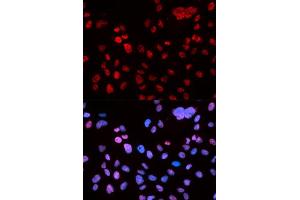 Immunofluorescence analysis of U2OS cell using Phospho-TP53-S9 antibody. (p53 antibody  (pSer9))
