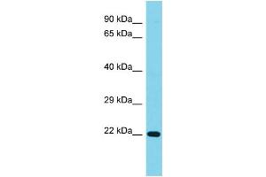Host: Rabbit Target Name: C1orf158 Sample Type: Jurkat Whole Cell lysates Antibody Dilution: 1.