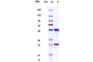 Anti-CD93 Reference Antibody (Dcby02) on SDS-PAGE under reducing (R) condition.