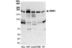 anti-Regulating Synaptic Membrane Exocytosis 1 (RIMS1) (AA 975-1025) antibody