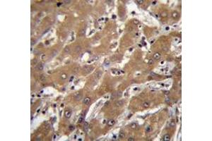 Immunohistochemistry analysis in human liver tissue (Formalin-fixed, Paraffin-embedded) using SPOPL Antibody , followed by peroxidase conjugation of the secondary antibody and DAB staining. (SPOPL antibody  (Middle Region))