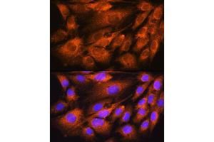 Immunofluorescence analysis of C6 cells using D antibody (ABIN6129731, ABIN6137329, ABIN6137330 and ABIN6225254) at dilution of 1:100. (ATP5F1D antibody  (AA 1-168))