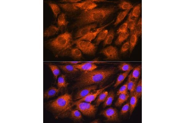 ATP5F1D antibody  (AA 1-168)