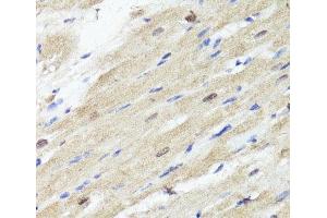 Immunohistochemistry of paraffin-embedded Rat heart using ACSS2 Polyclonal Antibody at dilution of 1:100 (40x lens). (ACSS2 antibody)