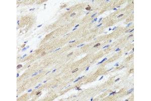 Immunohistochemistry of paraffin-embedded Rat heart using ACSS2 Polyclonal Antibody at dilution of 1:100 (40x lens). (ACSS2 antibody)