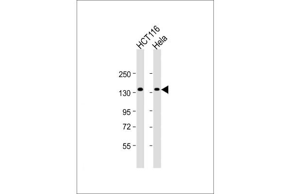 ANKS1A Antikörper  (N-Term)