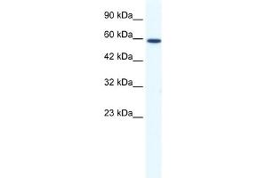WB Suggested Anti-DDX5 Antibody Titration:  1. (DDX5 antibody  (N-Term))
