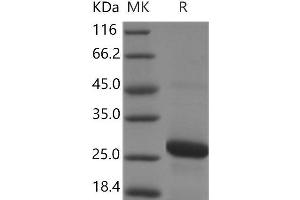 RAB7A Protein (His tag)