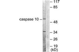 Western blot analysis of extracts from HeLa cells, using Caspase 10 Antibody. (Caspase 10 antibody  (AA 430-479))