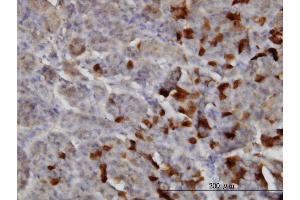 Immunoperoxidase of monoclonal antibody to LAMA2 on formalin-fixed paraffin-embedded human pancreas. (Laminin antibody  (AA 3013-3122))